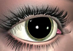 dilation eye exam